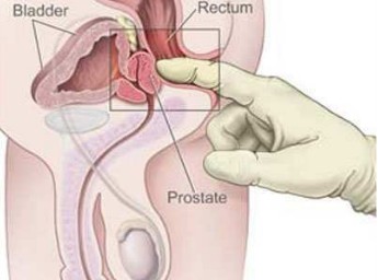 前列腺按摩手法教程【手把手教会前列腺自我按摩】